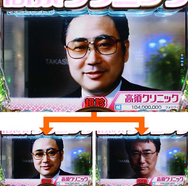 ぱちんこ・yes!高須クリニック~超整形BLACK~・超診